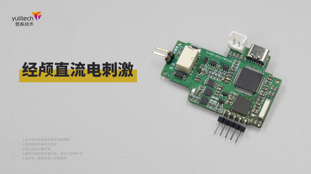 經(jīng)顱直流電刺激.jpg